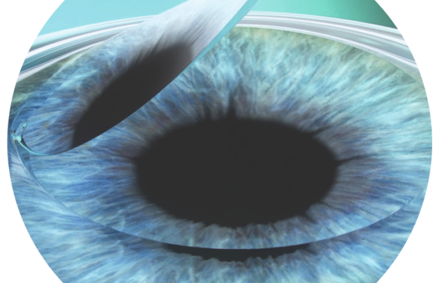 فمتو لیزیک مهدی محمدخانی