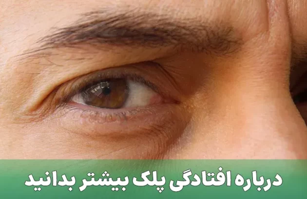 افتادگی پلک