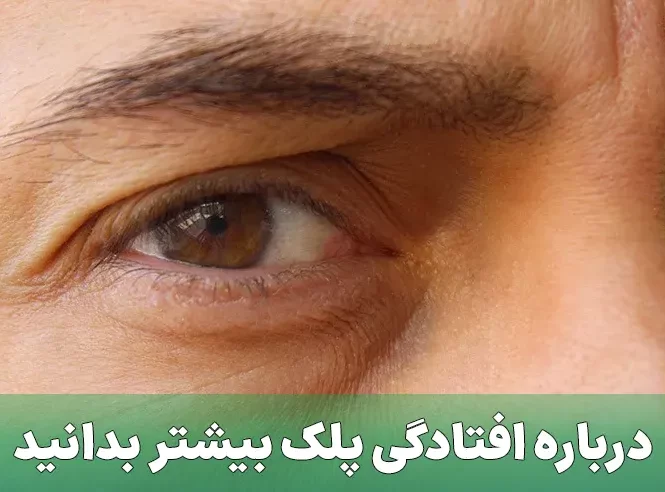 افتادگی پلک