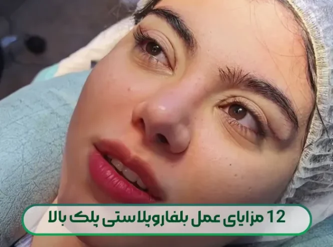 12 مزایای عمل بلفاروپلاستی پلک بالا