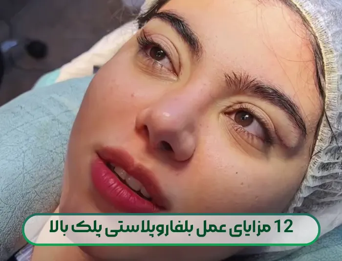 12 مزایای عمل بلفاروپلاستی پلک بالا