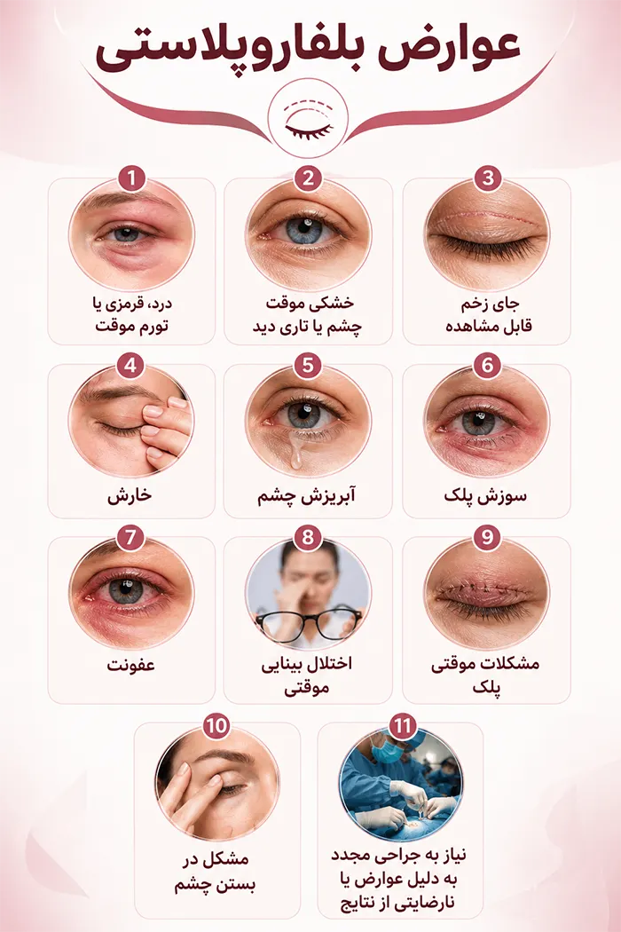 عوارض بلفاروپلاستی