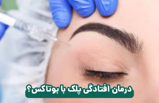 درمان افتادگی پلک با بوتاکس امکان پذیر است؟