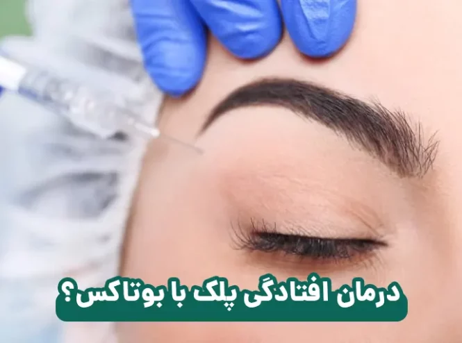 درمان افتادگی پلک با بوتاکس امکان پذیر است؟