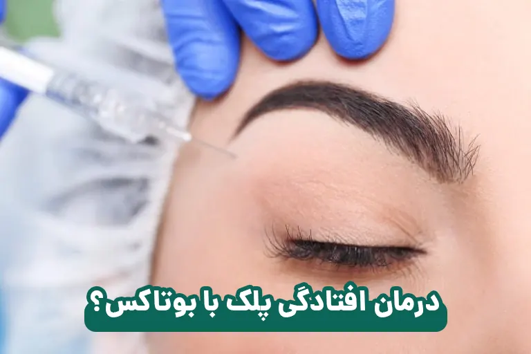 درمان افتادگی پلک با بوتاکس امکان پذیر است؟