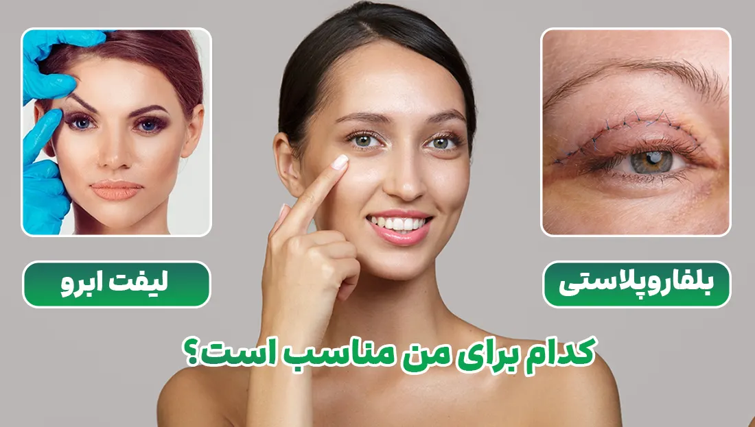 بلفاروپلاستی یا لیفت ابرو