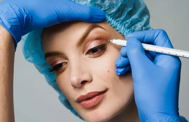 بلفاروپلاستی پلک بالا