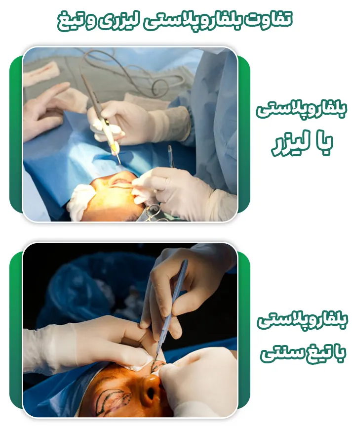 بلفاروپلاستی با لیزر و تیغ