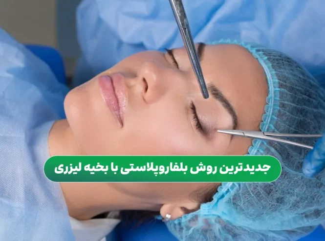 جدیدترین روش بلفاروپلاستی با بخیه لیزری