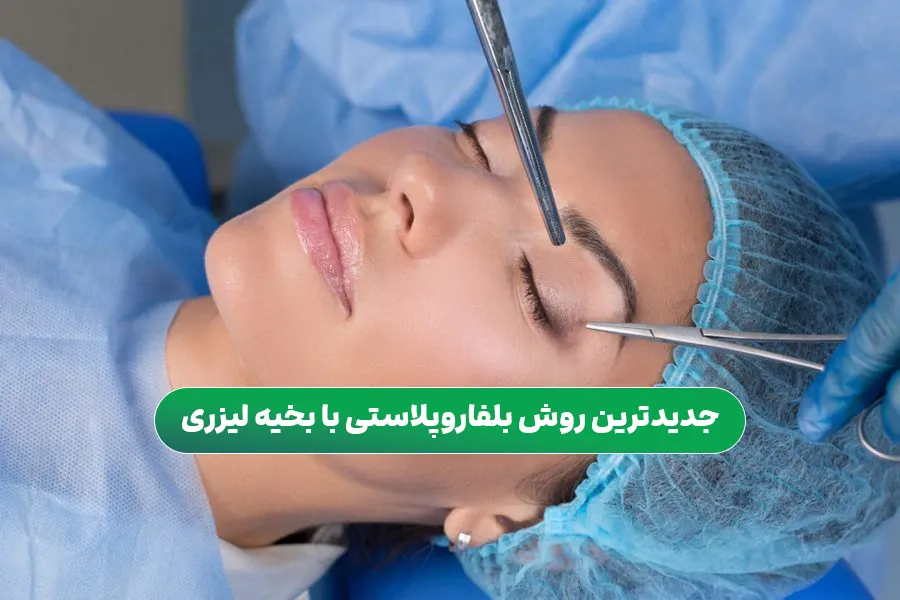 جدیدترین روش بلفاروپلاستی با بخیه لیزری