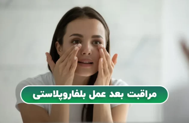 مراقبت بعد عمل بلفاروپلاستی