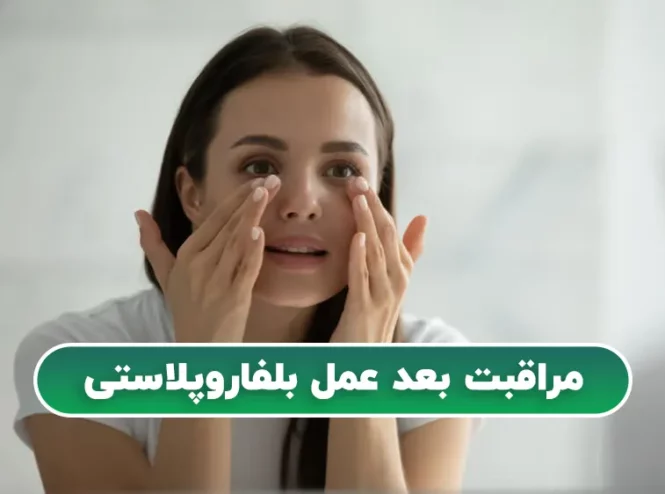 مراقبت بعد عمل بلفاروپلاستی