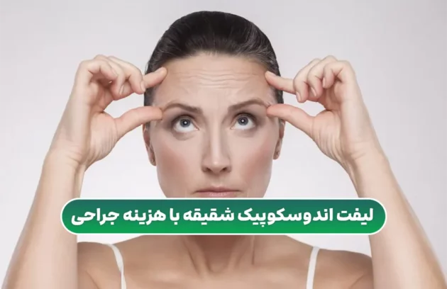 لیفت اندوسکوپیک شقیقه با هزینه جراحی