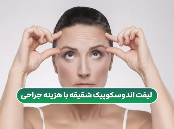 لیفت اندوسکوپیک شقیقه با هزینه جراحی