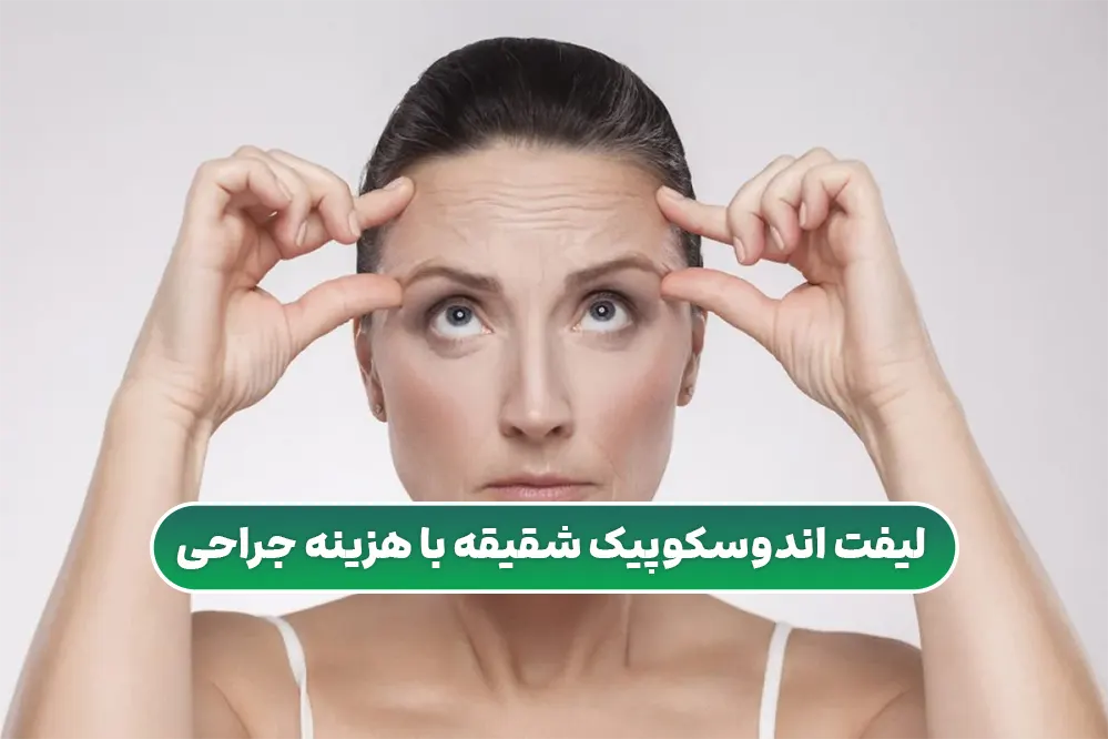 لیفت اندوسکوپیک شقیقه با هزینه جراحی