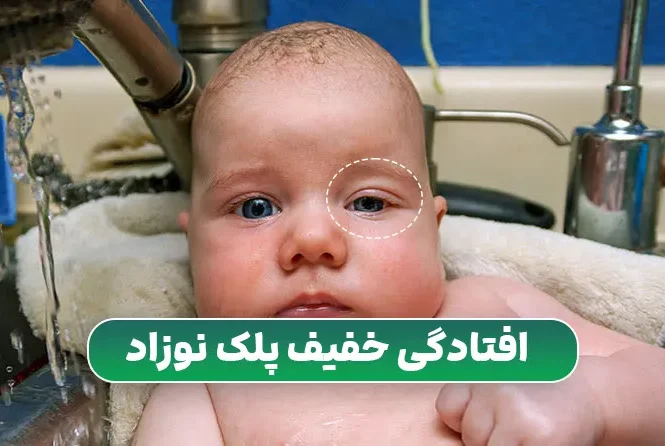 افتادگی خفیف پلک نوزاد