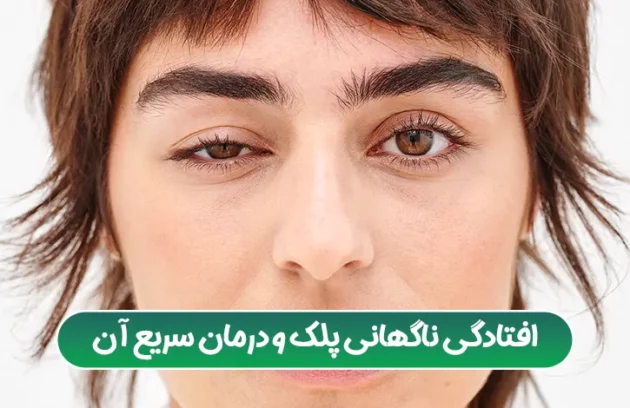 افتادگی ناگهانی پلک و درمان سریع آن