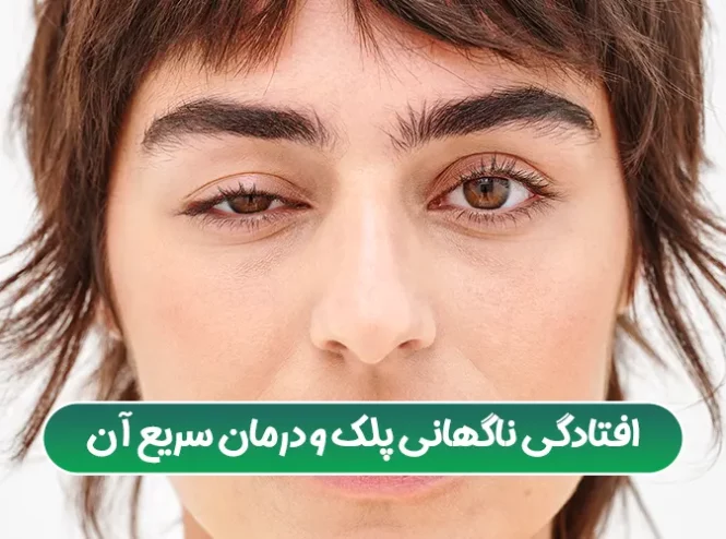 افتادگی ناگهانی پلک و درمان سریع آن