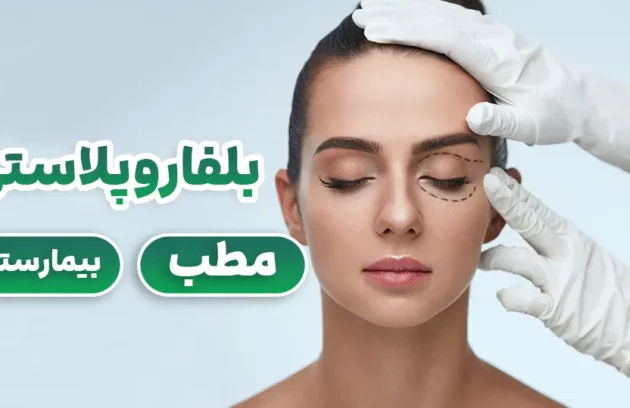 بلفاروپلاستی در بیمارستان یا مطب