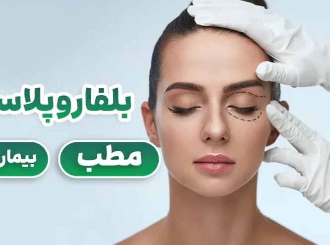 بلفاروپلاستی در بیمارستان یا مطب