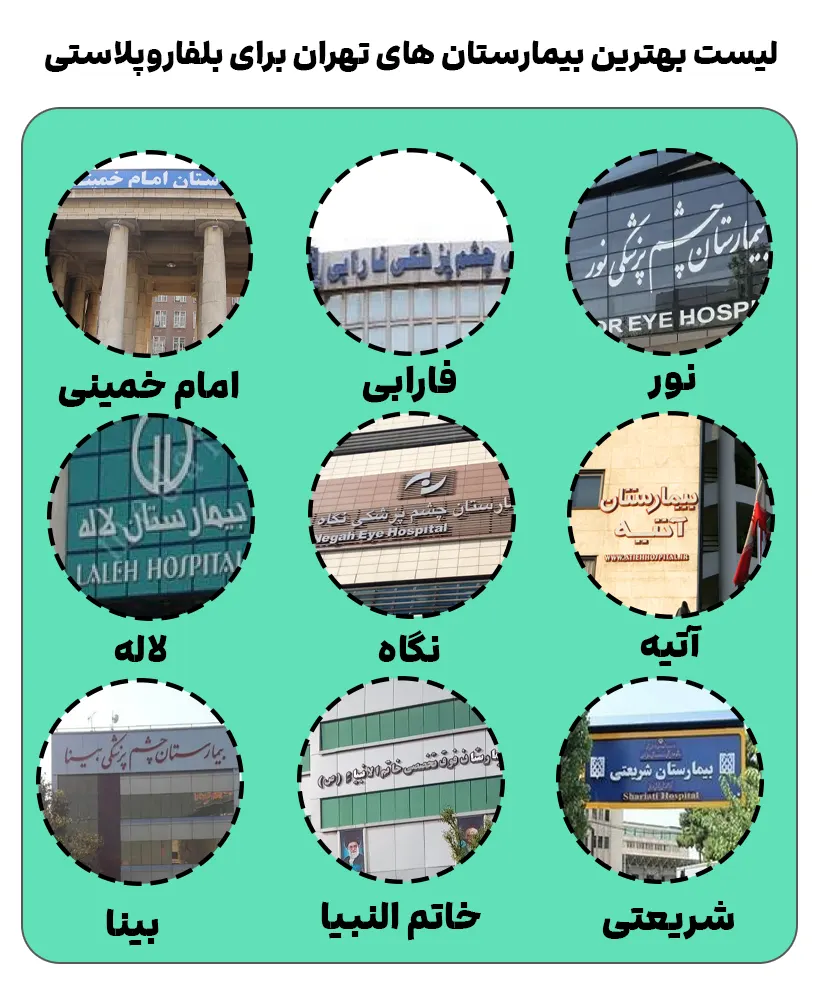 لیست بهترین بیمارستان های تهران برای بلفاروپلاستی