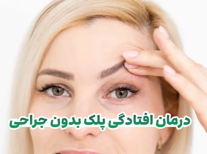 درمان افتادگی پلک بدون جراحی امکان پذیر است؟