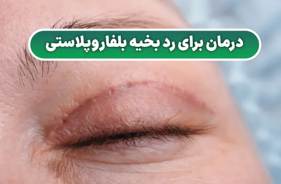 درمان ها برای رد بخیه بلفاروپلاستی