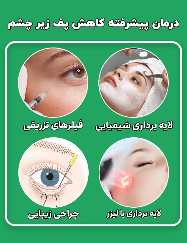 درمان های پزشکی برای کاهش پف زیر چشم