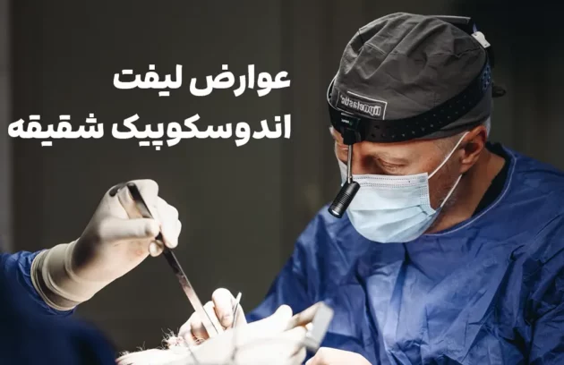 عوارض لیفت اندوسکوپیک شقیقه