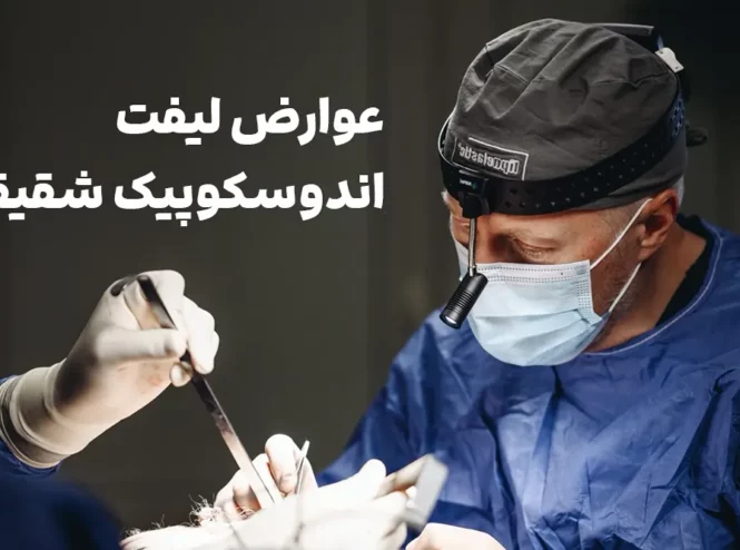 عوارض لیفت اندوسکوپیک شقیقه