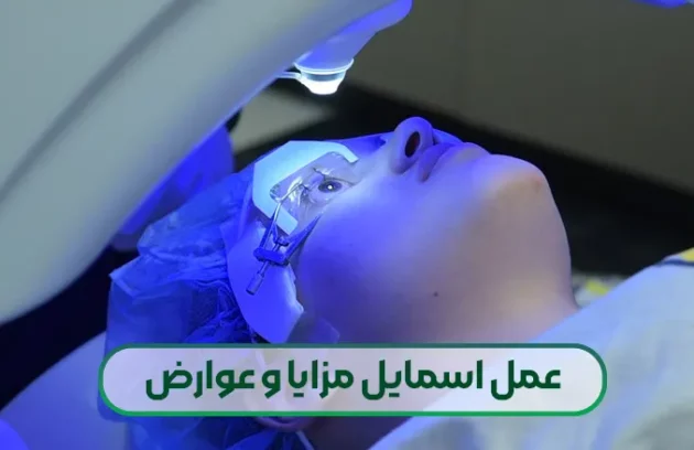 عمل اسمایل چشم