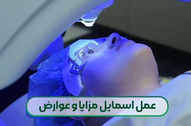 عمل اسمایل چشم