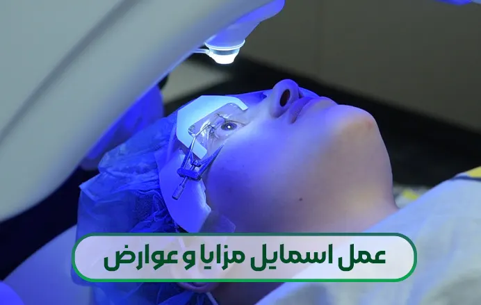 عمل اسمایل چشم