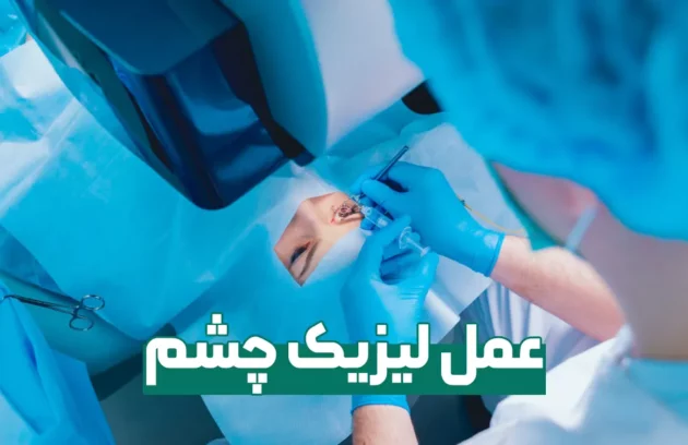 عمل لیزیک چشم