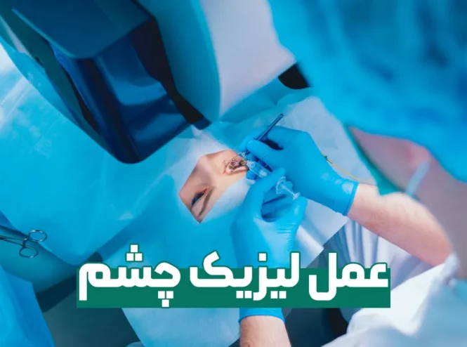 عمل لیزیک چشم