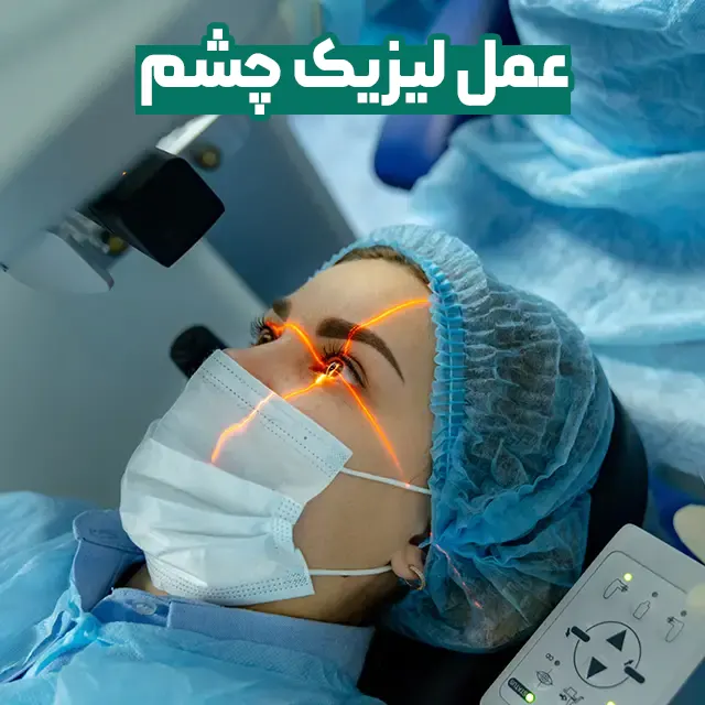 عمل لیزیک چشم