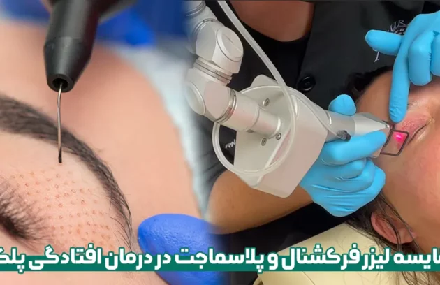 مقایسه لیزر فرکشنال و پلاسماجت در درمان افتادگی پلک
