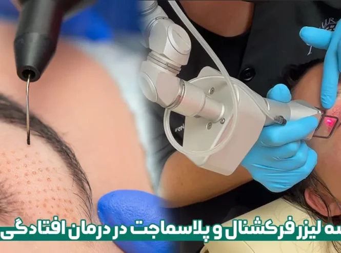 مقایسه لیزر فرکشنال و پلاسماجت در درمان افتادگی پلک