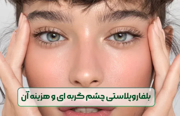 بلفاروپلاستی چشم گربه ای و هزینه جراحی آن