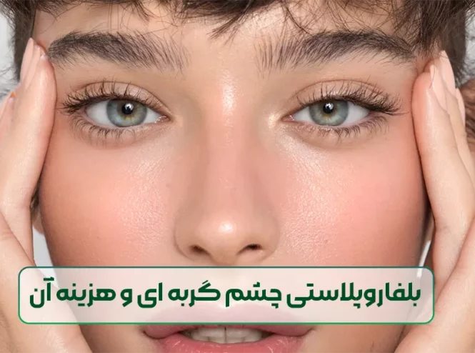 بلفاروپلاستی چشم گربه ای و هزینه جراحی آن