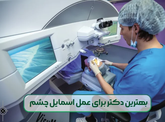 بهترین دکتر برای عمل اسمایل چشم