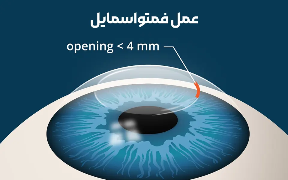 عمل فمتواسمایل