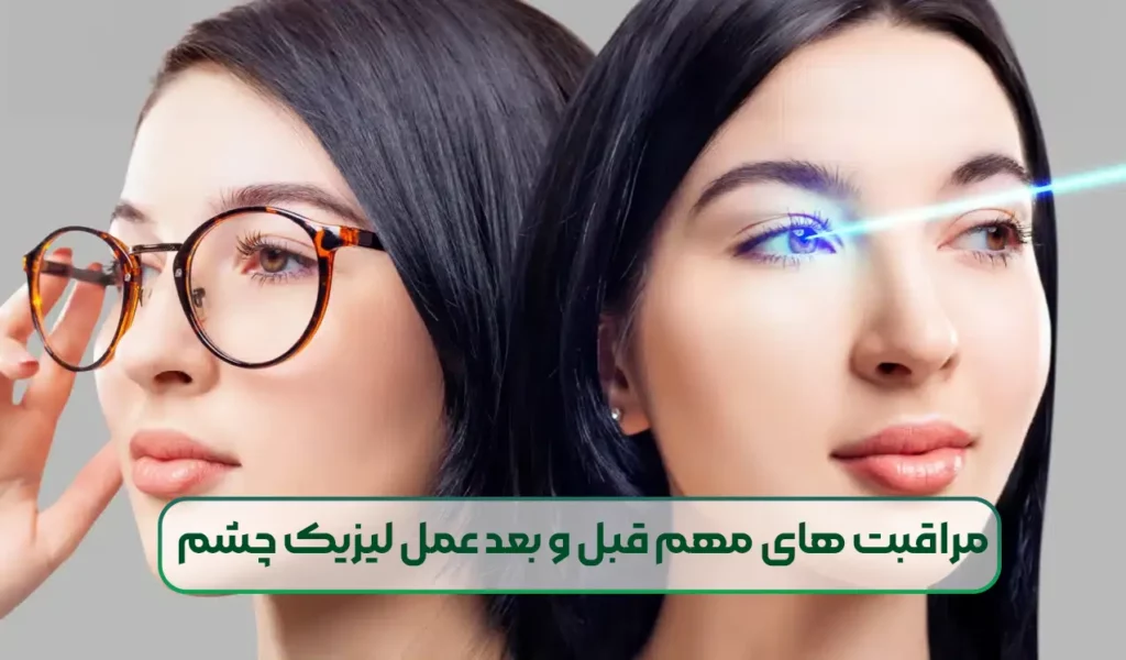 مراقبت های مهم قبل و بعد عمل لیزیک چشم