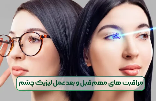 مراقبت های مهم قبل و بعد عمل لیزیک چشم