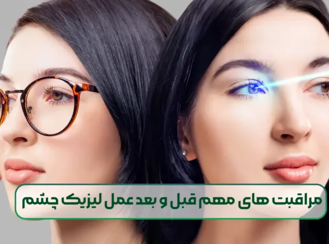 مراقبت های مهم قبل و بعد عمل لیزیک چشم