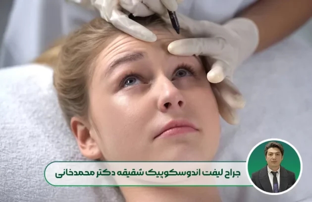 معرفی جراح لیفت اندوسکوپیک شقیقه دکتر مهدی محمدخانی