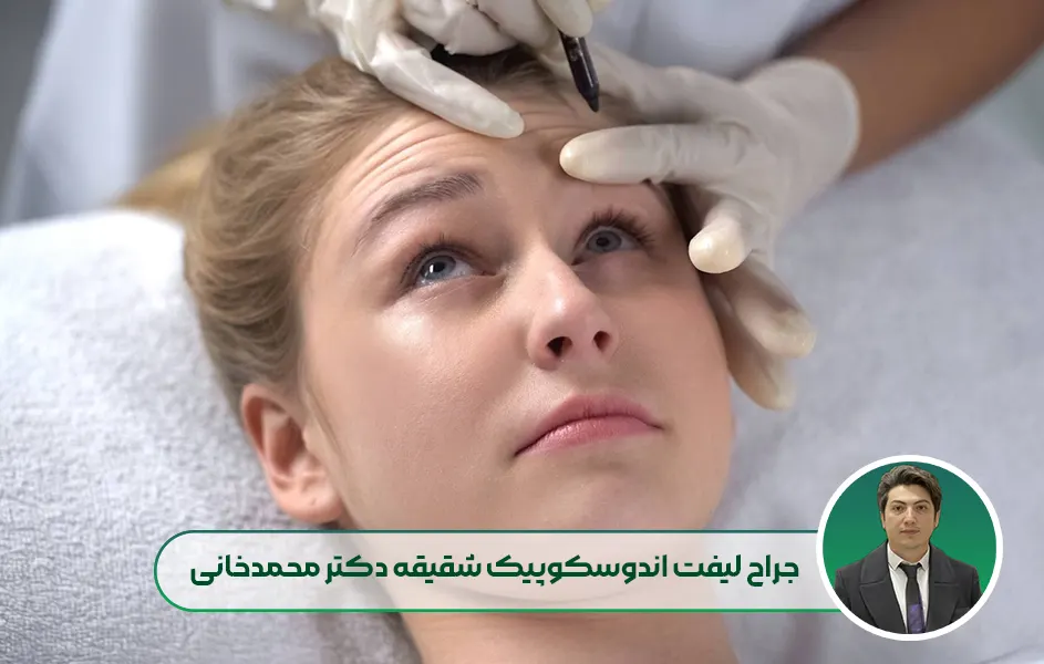 معرفی جراح لیفت اندوسکوپیک شقیقه دکتر مهدی محمدخانی