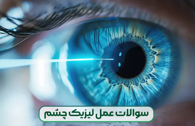 پاسخ به تمامی سوالات در مورد عمل لیزیک چشم