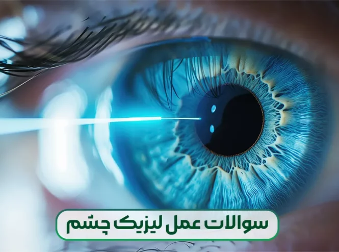 پاسخ به تمامی سوالات در مورد عمل لیزیک چشم