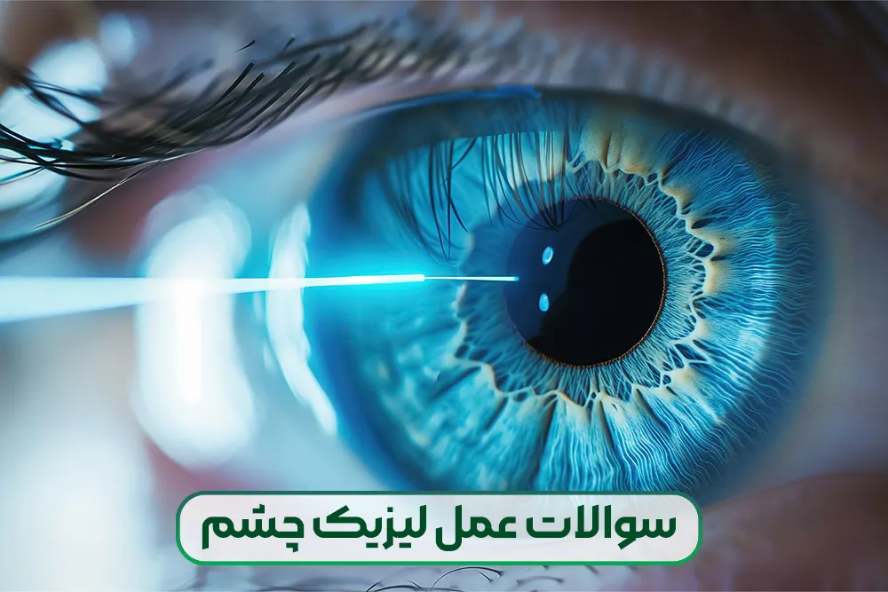 پاسخ به تمامی سوالات در مورد عمل لیزیک چشم